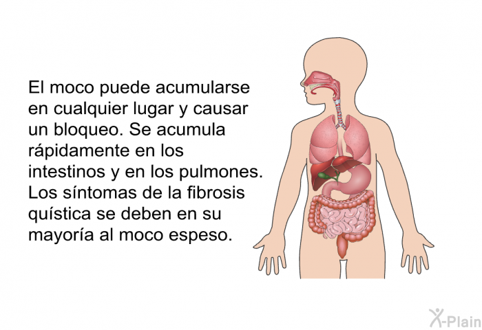 El moco puede acumularse en cualquier lugar y causar un bloqueo. Se acumula rpidamente en los intestinos y en los pulmones. Los sntomas de la fibrosis qustica se deben en su mayora al moco espeso.