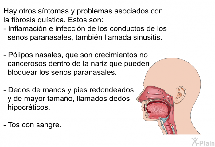 Hay otros sntomas y problemas asociados con la fibrosis qustica. Estos son:  Inflamacin e infeccin de los conductos de los senos paranasales, tambin llamada sinusitis. Plipos nasales, que son crecimientos no cancerosos dentro de la nariz que pueden bloquear los senos paranasales. Dedos de manos y pies redondeados y de mayor tamao, llamados dedos hipocrticos. Tos con sangre.
