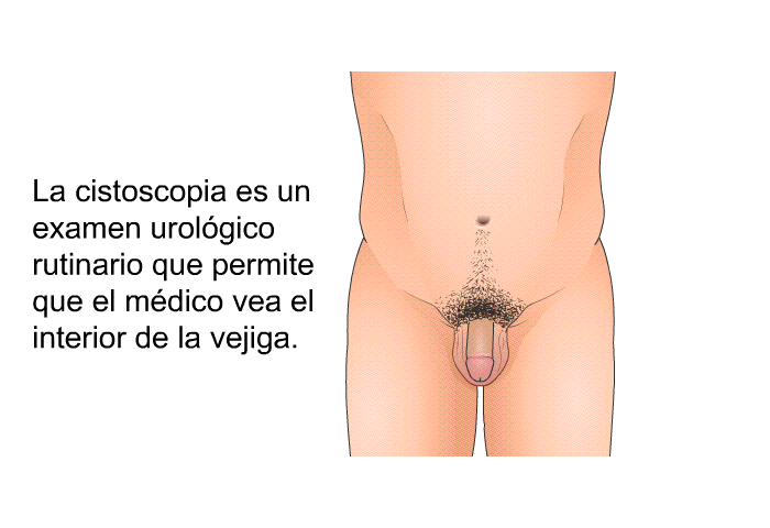 La cistoscopia es un examen urolgico rutinario que permite que el mdico vea el interior de la vejiga.