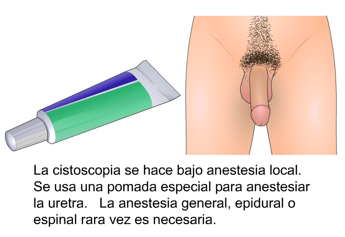 La cistoscopia se hace bajo anestesia local. Se usa una pomada especial para anestesiar la uretra. La anestesia general, epidural o espinal rara vez es necesaria.