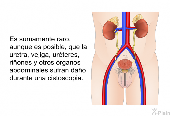 Es sumamente raro, aunque es posible, que la uretra, vejiga, ur�teres, ri�ones y otros �rganos abdominales sufran da�o durante una cistoscopia.