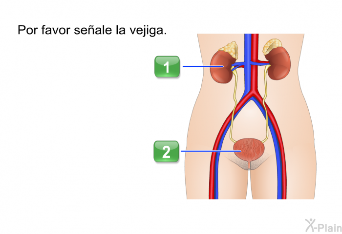 Por favor seale la vejiga.