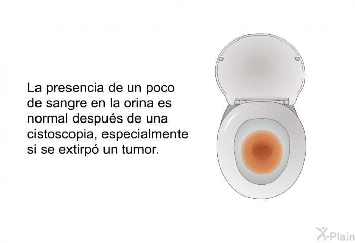 La presencia de un poco de sangre en la orina es normal despus de una cistoscopia, especialmente si se extirp un tumor.