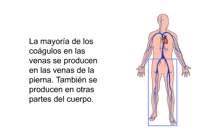 La mayora de los cogulos en las venas se producen en las venas de la pierna. Tambin se producen en otras partes del cuerpo.