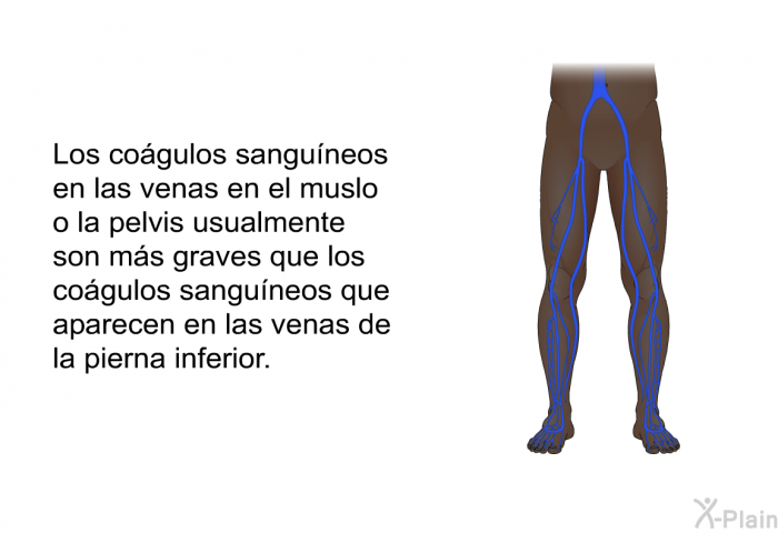 Los cogulos sanguneos en las venas en el muslo o la pelvis usualmente son ms graves que los cogulos sanguneos que aparecen en las venas de la pierna inferior.