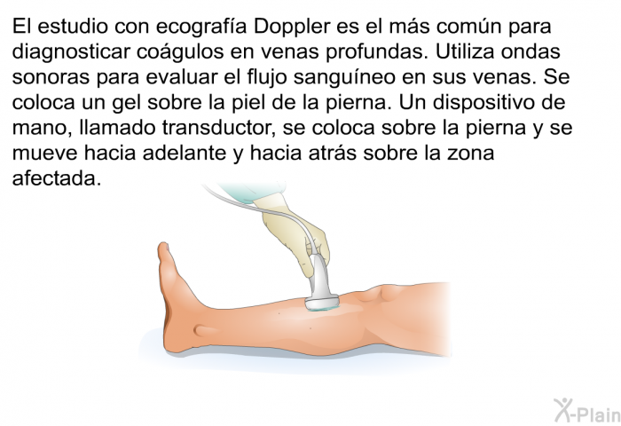 El estudio con ecograf�a Doppler es el m�s com�n para diagnosticar co�gulos en venas profundas. Utiliza ondas sonoras para evaluar el flujo sangu�neo en sus venas. Se coloca un gel sobre la piel de la pierna. Un dispositivo de mano, llamado transductor, se coloca sobre la pierna y se mueve hacia adelante y hacia atr�s sobre la zona afectada.