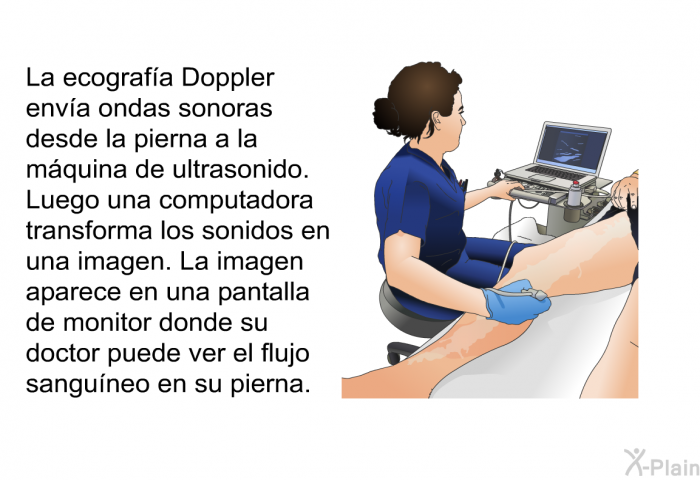 La ecograf�a Doppler env�a ondas sonoras desde la pierna a la m�quina de ultrasonido. Luego una computadora transforma los sonidos en una imagen. La imagen aparece en una pantalla de monitor donde su doctor puede ver el flujo sangu�neo en su pierna.