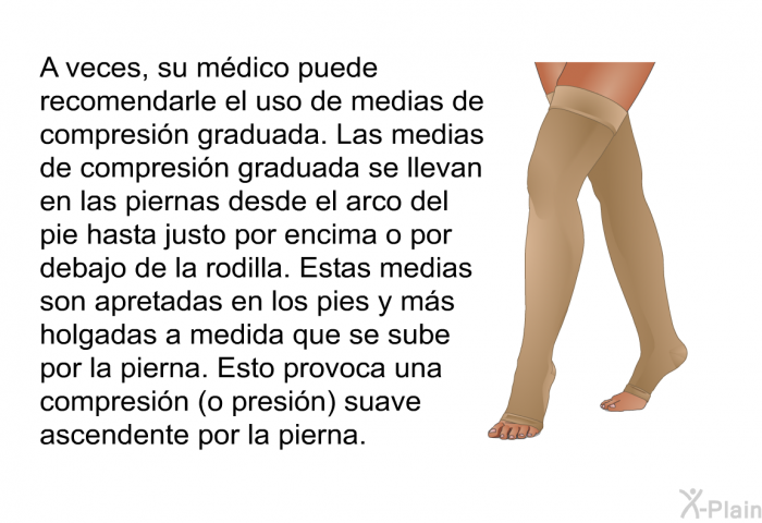 A veces, su mdico puede recomendarle el uso de medias de compresin graduada. Las medias de compresin graduada se llevan en las piernas desde el arco del pie hasta justo por encima o por debajo de la rodilla. Estas medias son apretadas en los pies y ms holgadas a medida que se sube por la pierna. Esto provoca una compresin (o presin) suave ascendente por la pierna.