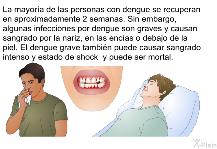 La mayora de las personas con dengue se recuperan en aproximadamente 2 semanas. Sin embargo, algunas infecciones por dengue son graves y causan sangrado por la nariz, en las encas o debajo de la piel. El dengue grave tambin puede causar sangrado intenso y estado de shock y puede ser mortal.