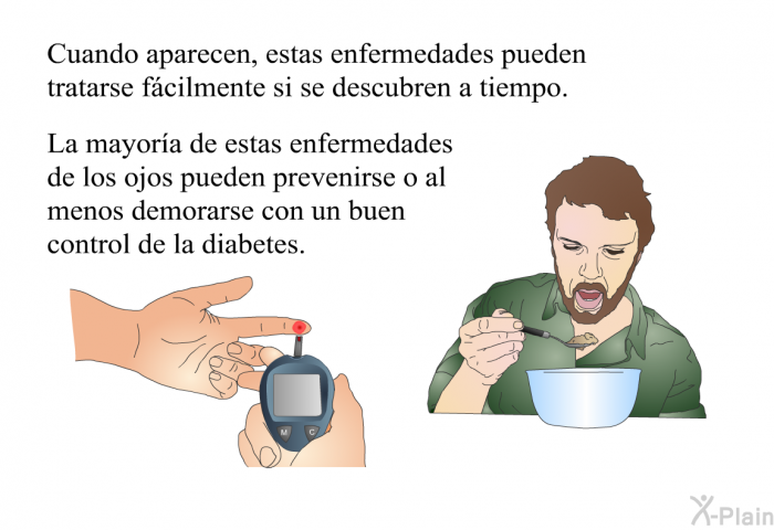 Cuando aparecen, estas enfermedades pueden tratarse fcilmente si se descubren a tiempo. La mayora de estas enfermedades de los ojos pueden prevenirse o al menos demorarse con un buen control de la diabetes.