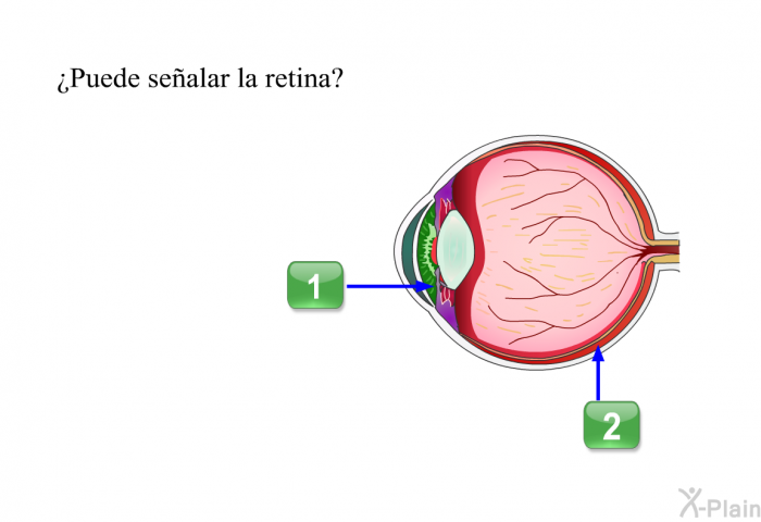 ¿Puede sealar la retina?