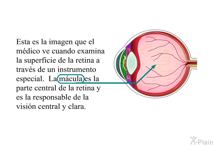 Esta es la imagen que el mdico ve cuando examina la superficie de la retina a travs de un instrumento especial. La mcula es la parte central de la retina y es la responsable de la visin central y clara.