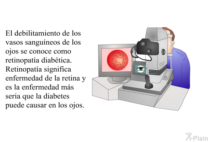 El debilitamiento de los vasos sanguneos de los ojos se conoce como retinopata diabtica. Retinopata significa enfermedad de la retina y es la enfermedad ms seria que la diabetes puede causar en los ojos.