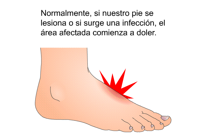 Normalmente, si nuestro pie se lesiona o si surge una infeccin, el rea afectada comienza a doler.