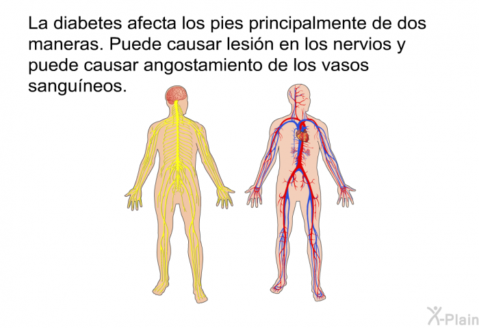 La diabetes afecta los pies principalmente de dos maneras. Puede causar lesin en los nervios y puede causar angostamiento de los vasos sanguneos.