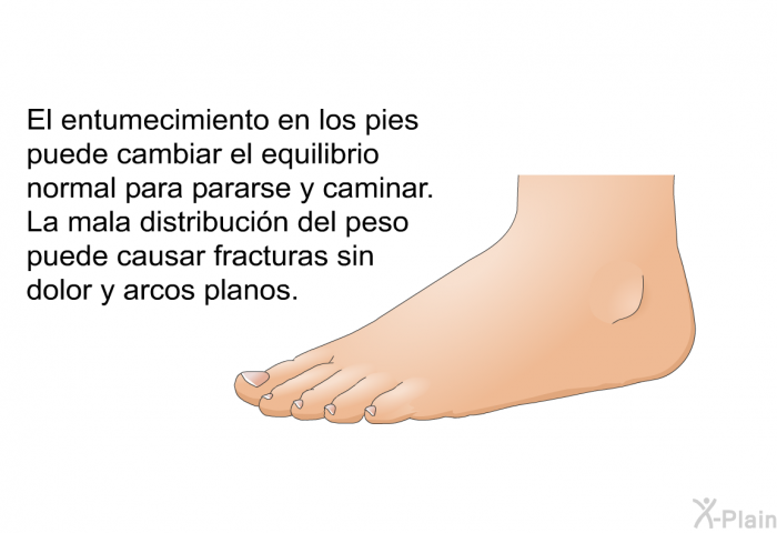 El entumecimiento en los pies puede cambiar el equilibrio normal para pararse y caminar. La mala distribucin del peso puede causar fracturas sin dolor y arcos planos.