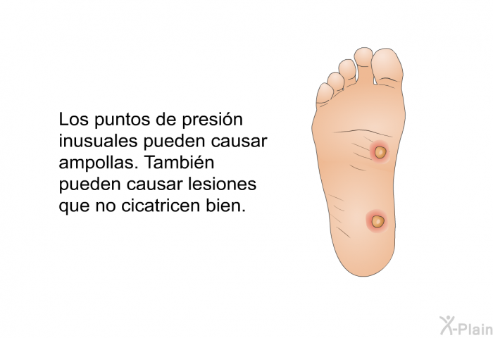 Los puntos de presin inusuales pueden causar ampollas. Tambin pueden causar lesiones que no cicatricen bien.