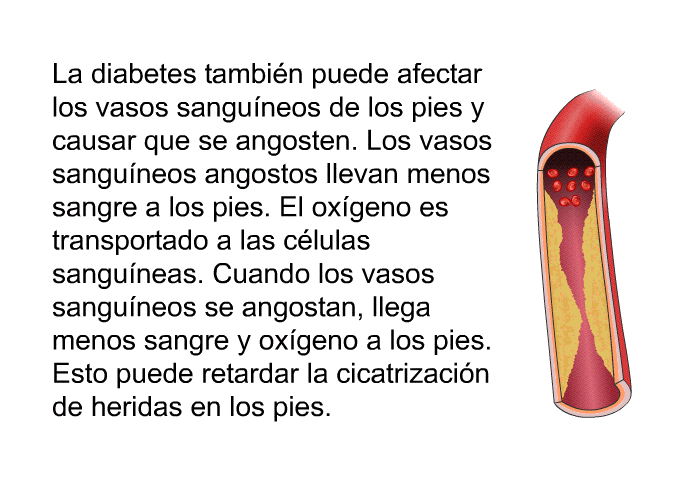 La diabetes tambin puede afectar los vasos sanguneos de los pies y causar que se angosten. Los vasos sanguneos angostos llevan menos sangre a los pies. El oxgeno es transportado a las clulas sanguneas. Cuando los vasos sanguneos se angostan, llega menos sangre y oxgeno a los pies. Esto puede retardar la cicatrizacin de heridas en los pies.