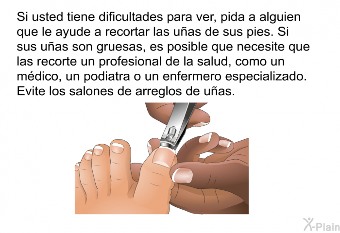Si usted tiene dificultades para ver, pida a alguien que le ayude a recortar las uas de sus pies. Si sus uas son gruesas, es posible que necesite que las recorte un profesional de la salud, como un mdico, un podiatra o un enfermero especializado. Evite los salones de arreglos de uas.