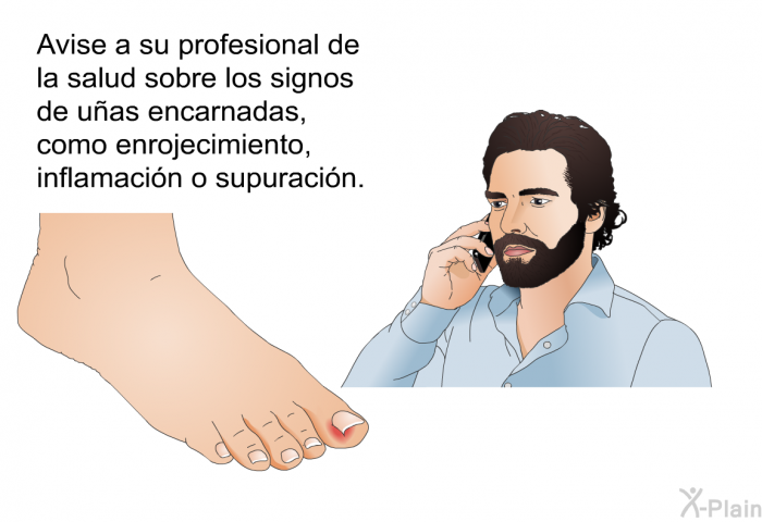 Avise a su profesional de la salud sobre los signos de uas encarnadas, como enrojecimiento, inflamacin o supuracin.