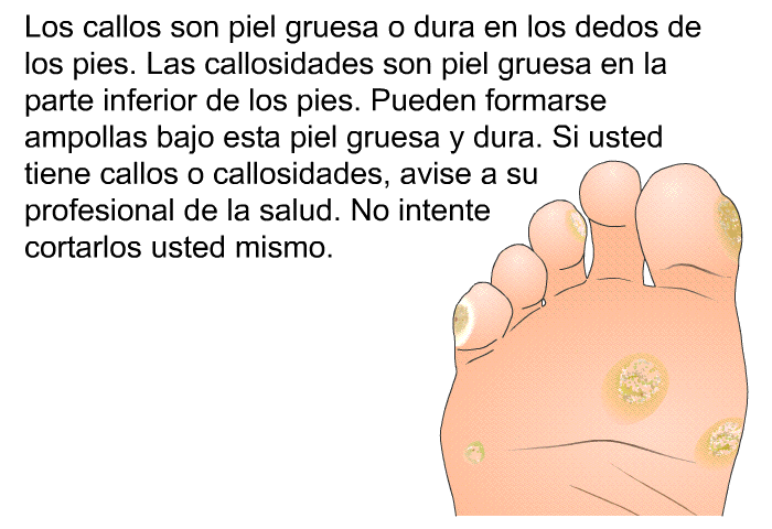 Los callos son piel gruesa o dura en los dedos de los pies. Las callosidades son piel gruesa en la parte inferior de los pies. Pueden formarse ampollas bajo esta piel gruesa y dura. Si usted tiene callos o callosidades, avise a su profesional de la salud. No intente cortarlos usted mismo.