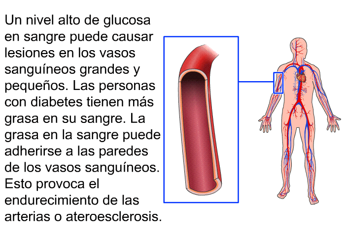 Un nivel alto de glucosa en sangre puede causar lesiones en los vasos sangu�neos grandes y peque�os. Las personas con diabetes tienen m�s grasa en su sangre. La grasa en la sangre puede adherirse a las paredes de los vasos sangu�neos. Esto provoca el endurecimiento de las arterias o ateroesclerosis.