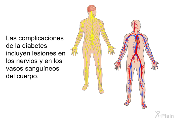 Las complicaciones de la diabetes incluyen lesiones en los nervios y en los vasos sangu�neos del cuerpo.
