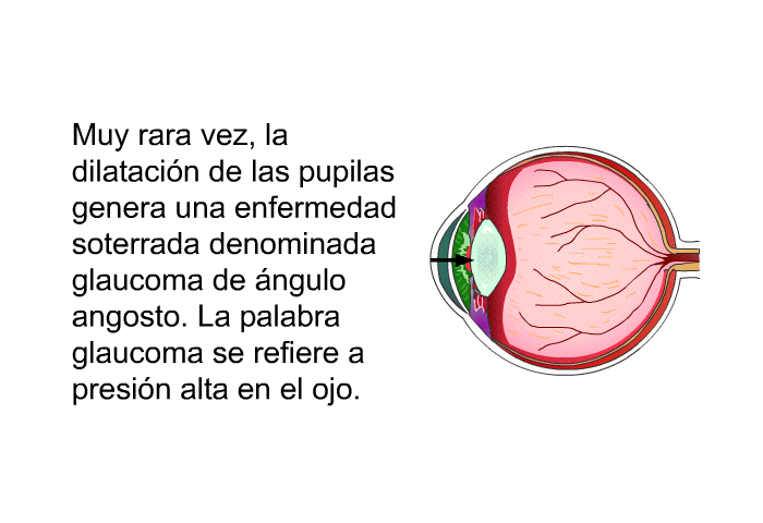 Muy rara vez, la dilataci�n de las pupilas genera una enfermedad soterrada denominada glaucoma de �ngulo angosto. La palabra glaucoma se refiere a presi�n alta en el ojo.