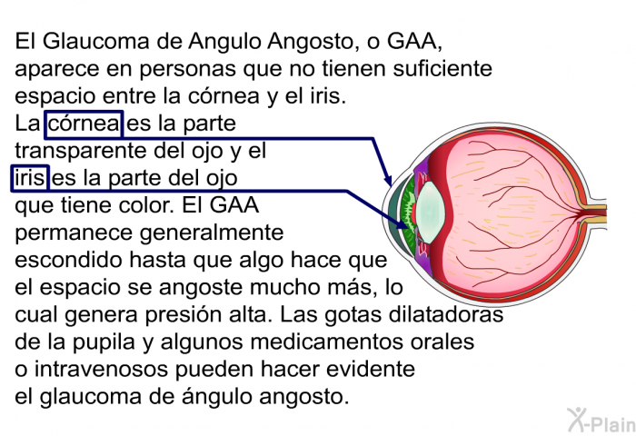 El Glaucoma de Angulo Angosto, o GAA, aparece en personas que no tienen suficiente espacio entre la c�rnea y el iris. La c�rnea es la parte transparente del ojo y el iris es la parte del ojo que tiene color. El GAA permanece generalmente escondido hasta que algo hace que el espacio se angoste mucho m�s, lo cual genera presi�n alta. Las gotas dilatadoras de la pupila y algunos medicamentos orales o <I>intravenosos</I> pueden hacer evidente el glaucoma de �ngulo angosto.