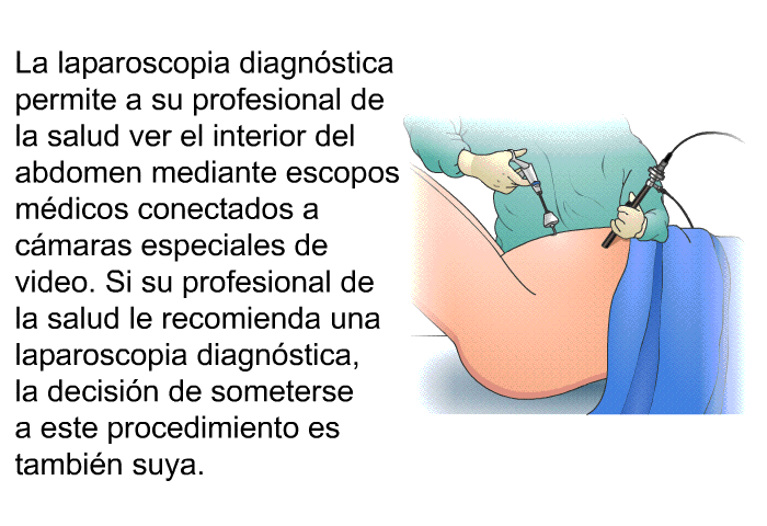 La laparoscopia diagnstica permite a su profesional de la salud ver el interior del abdomen mediante escopos mdicos conectados a cmaras especiales de video. Si su profesional de la salud le recomienda una laparoscopia diagnstica, la decisin de someterse a este procedimiento es tambin suya.