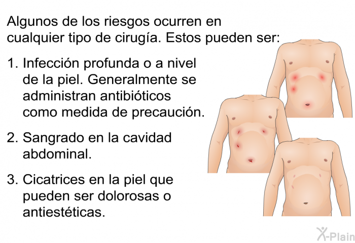 Algunos de los riesgos ocurren en cualquier tipo de ciruga. Estos pueden ser:  Infeccin profunda o a nivel de la piel. Generalmente se administran antibiticos como medida de precaucin. Sangrado en la cavidad abdominal. Cicatrices en la piel que pueden ser dolorosas o antiestticas.