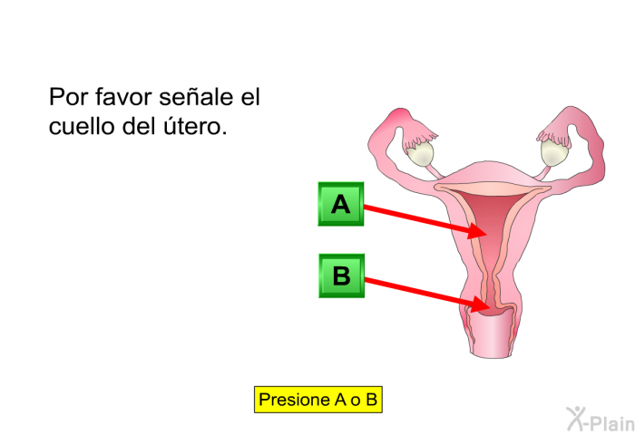 Por favor seale el cuello del tero.