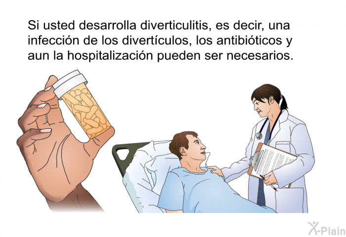 Si usted desarrolla diverticulitis, es decir, una infeccin de los divertculos, los antibiticos y aun la hospitalizacin pueden ser necesarios.