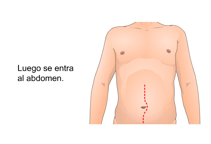 Luego se entra al abdomen.