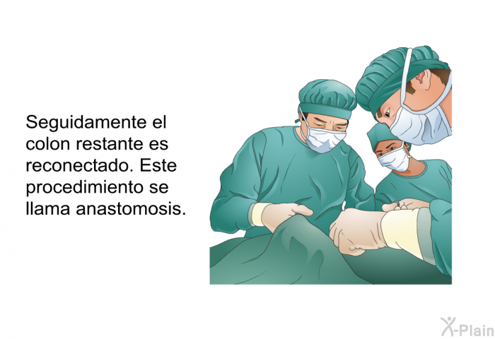 Seguidamente el colon restante es reconectado. Este procedimiento se llama anastomosis.