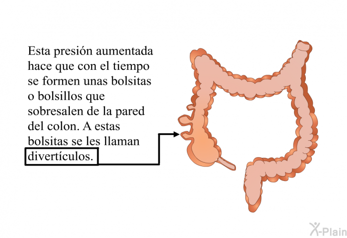 Esta presin aumentada hace que con el tiempo se formen unas bolsitas o bolsillos que sobresalen de la pared del colon. A estas bolsitas se les llaman divertculos.