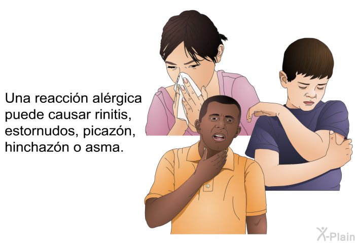 Una reaccin alrgica puede causar rinitis, estornudos, picazn, hinchazn o asma.