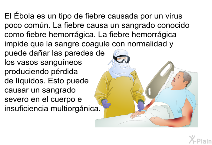 El Ébola es un tipo de fiebre causada por un virus poco comn. La fiebre causa un sangrado conocido como fiebre hemorrgica. La fiebre hemorrgica impide que la sangre coagule con normalidad y puede daar las paredes de los vasos sanguneos produciendo prdida de lquidos. Esto puede causar un sangrado severo en el cuerpo e insuficiencia multiorgnica.