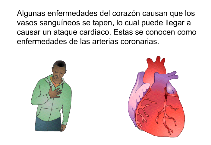 Algunas enfermedades del corazn causan que los vasos sanguneos se tapen, lo cual puede llegar a causar un ataque cardiaco. Estas se conocen como enfermedades de las arterias coronarias.