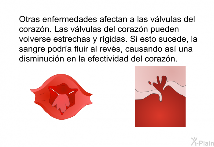 Otras enfermedades afectan a las vlvulas del corazn. Las vlvulas del corazn pueden volverse estrechas y rgidas. Si esto sucede, la sangre podra fluir al revs, causando as una disminucin en la efectividad del corazn.