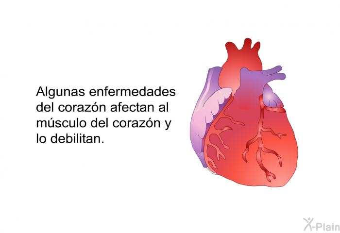 Algunas enfermedades del corazn afectan al msculo del corazn y lo debilitan.