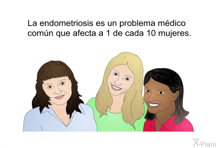 La endometriosis es un problema mdico comn que afecta a 1 de cada 10 mujeres.