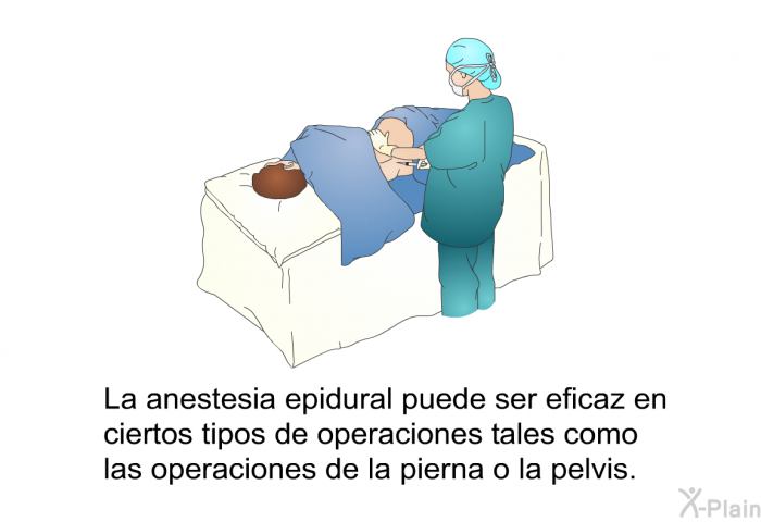 La anestesia epidural puede ser eficaz en ciertos tipos de operaciones tales como las operaciones de la pierna o la pelvis.