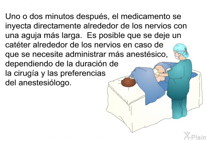 Uno o dos minutos despus, el medicamento se inyecta directamente alrededor de los nervios con una aguja ms larga. Es posible que se deje un catter alrededor de los nervios en caso de que se necesite administrar ms anestsico, dependiendo de la duracin de la ciruga y las preferencias del anestesilogo.