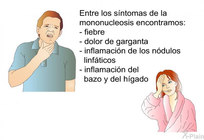 Entre los sntomas de la mononucleosis encontramos:  fiebre dolor de garganta inflamacin de los ndulos linfticos inflamacin del bazo y del hgado