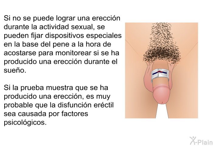 Si no se puede lograr una erecci�n durante la actividad sexual, se pueden fijar dispositivos especiales en la base del pene a la hora de acostarse para monitorear si se ha producido una erecci�n durante el sue�o. Si la prueba muestra que se ha producido una erecci�n, es muy probable que la disfunci�n er�ctil sea causada por factores psicol�gicos.