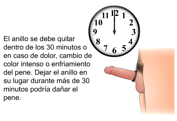 El anillo se debe quitar dentro de los 30 minutos o en caso de dolor, cambio de color intenso o enfriamiento del pene. Dejar el anillo en su lugar durante m�s de 30 minutos podr�a da�ar el pene.