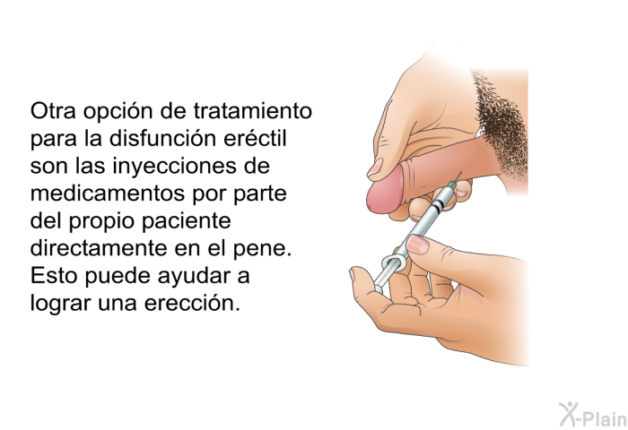 Otra opci�n de tratamiento para la disfunci�n er�ctil son las inyecciones de medicamentos por parte del propio paciente directamente en el pene. Esto puede ayudar a lograr una erecci�n.