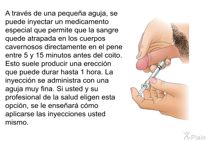 A trav�s de una peque�a aguja, se puede inyectar un medicamento especial que permite que la sangre quede atrapada en los cuerpos cavernosos directamente en el pene entre 5 y 15 minutos antes del coito. Esto suele producir una erecci�n que puede durar hasta 1 hora. La inyecci�n se administra con una aguja muy fina. Si usted y su profesional de la salud eligen esta opci�n, se le ense�ar� c�mo aplicarse las inyecciones usted mismo.