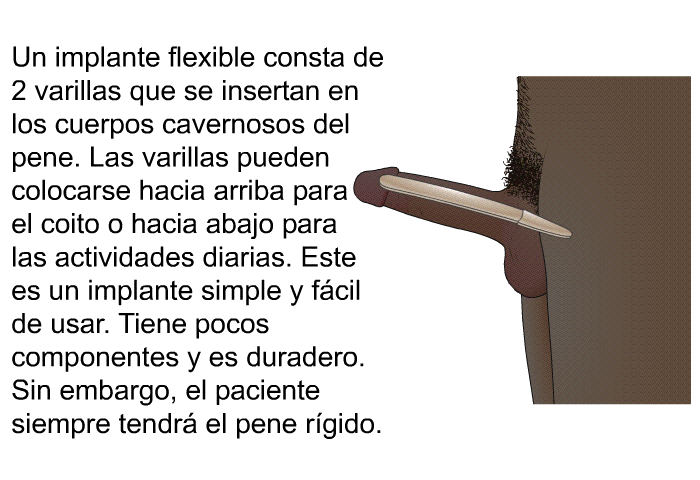 Un implante flexible consta de 2 varillas que se insertan en los cuerpos cavernosos del pene. Las varillas pueden colocarse hacia arriba para el coito o hacia abajo para las actividades diarias. Este es un implante simple y f�cil de usar. Tiene pocos componentes y es duradero. Sin embargo, el paciente siempre tendr� el pene r�gido.